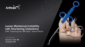 Lesser Metatarsal Instability with Shortening Osteotomy CPR™ Featuring the CPR Viper™ Suture Passer