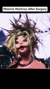 11K views · 55 reactions | Extreme Plastic Surgery Fails  #fyp #surgery #interesting | Podcast Clips | Facebook