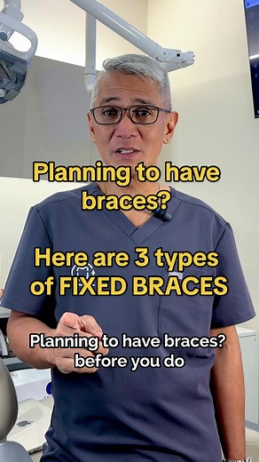 The Ultimate Guide to Braces: Types, Benefits, and Fast Braces