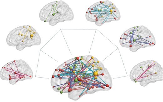 BrainNetViewer操作实例