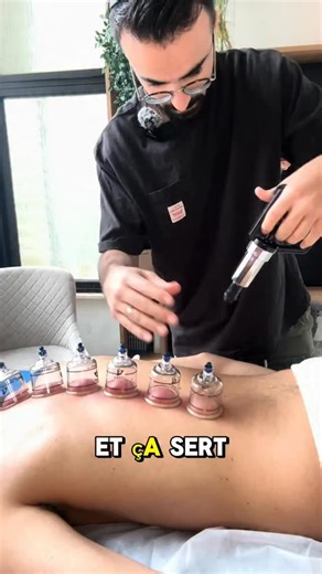 Nathan Sebbagh on Instagram: "Aujourd’hui avec Elie, on vous montre les ventouses dans une séance : à quoi ça sert, comment ça agit, et pourquoi on les utilise parfois en complément du massage. Les ventouses peuvent aider à : • relâcher certaines tensions musculaires • améliorer la mobilité d’une zone “bloquée” • favoriser la récupération après sport Ce n’est pas “magique”, et ce n’est pas pour tout le monde : on adapte toujours selon la douleur, la peau et l’objectif de la séance. Si tu veux qu