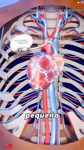 Cardiac pacemaker 3D