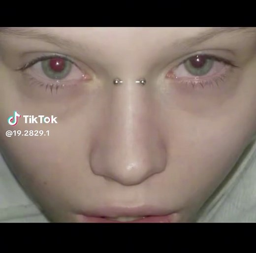 Bridge Piercing: A Guide to Swirly Style and Jewelry