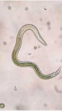 case of larva migrans - Radiology