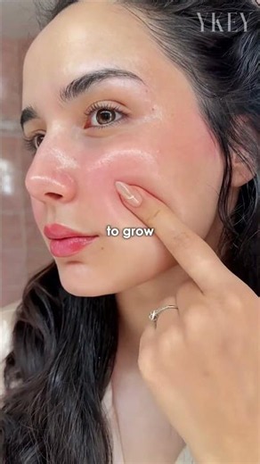 Whey Protein Is Giving You Chest Acne