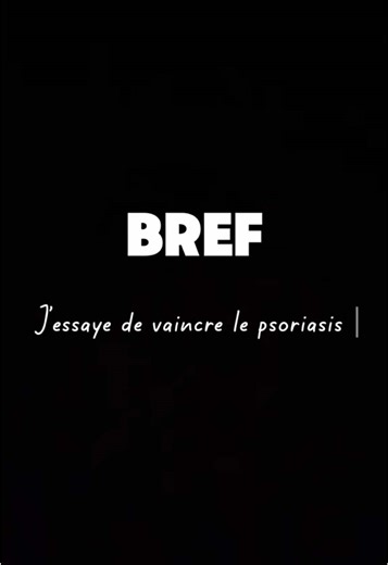 Comment j'ai vaincu le psoriasis du cuir chevelu