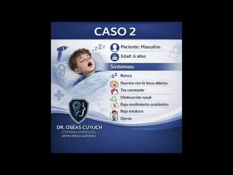 HIPERTROFIA DE ADENOIDES-VISTA ENDOSCOPICA