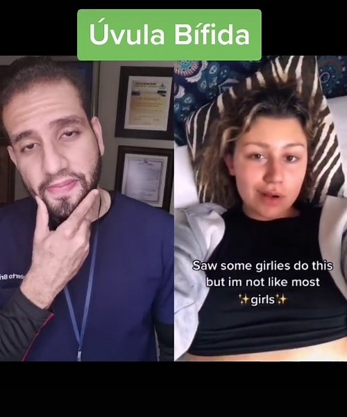 Understanding Úvula Bífida: Causes and Effects