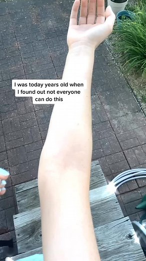 #fyp #doublejointedcheck