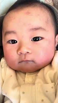 今日の末っ子ちゃん👶元気いっぱいです😄水疱瘡のあとの治りが悪い気が。。 #りおたけチャンネル #赤ちゃん #赤ちゃんのいる生活 #末っ子ちゃん #あかちゃん