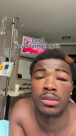 #medical #hospital #viral #infection No it’s not pinkeye | pink eye