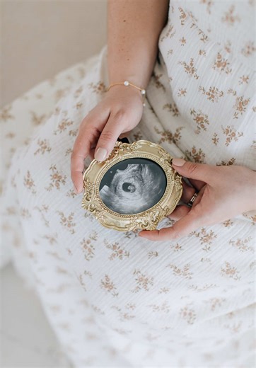 Our little miracle 🤍🕊️ We always wanted a family. We just didn’t know that there would be difficult journey ahead of us to welcome our little ones into our family. In October, I had my second egg retrieval and my husband had his second micro tese procedure. We were so hopeful that we would have multiple embryos this time around because they kept telling us that our chances would be better instead of using our frozen sperm — “fresh is best!” That was definitely different to undergo our surgerie