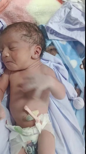 31K views · 593 reactions | First Observation Care of a Newborn in the NICU | Miracle Baby's First Moments. #NICUDischarge #NewbornCare #BabyObservation #NICUNurse #DischargeProcess #HealthyBaby #NeonatalCare #BabyCareTips #NICULife #HospitalCare #MedicalEducationIndia #HealthcareProfessionals | Zaib Neonatal Care | Facebook