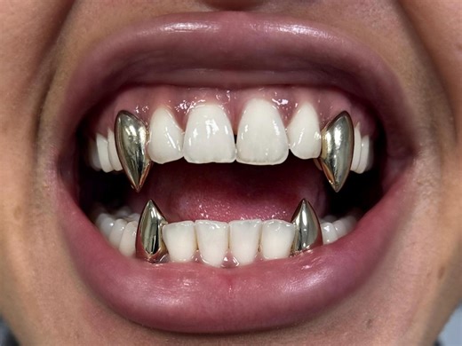 Custom Vampire Fang Grillz: K9 Tooth Caps, Silver or Gold - Etsy