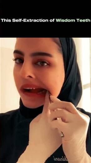 Dentist 🦷☠️ self extraction wisdom teeth 🔥 #shorts