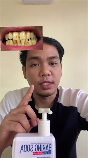 The Benefits of Baking Soda for Teeth Cleaning