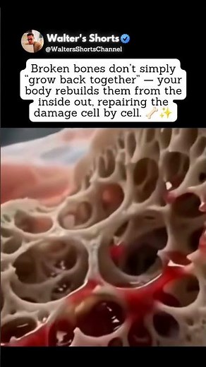 How Your Body Rebuilds Broken Bones 🦴🤯