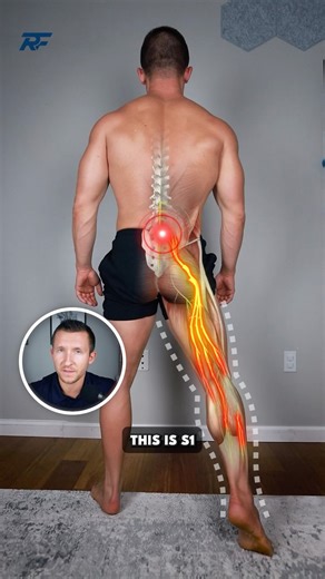 Dr. Grant Elliott on Instagram: "💥 Your Leg Pain Isn’t Random, It’s Nerve Pain. ❌ Shooting pain down the leg usually isn’t tight muscles. It’s often an irritated nerve from a disc issue. Those patterns point straight to irritated nerve roots, and most of the time the real culprit is a disc herniation pressing on one of them. 🔑 Try these 3 steps to lower nerve compression and regain mobility 👇 1️⃣ 90–90 Wall Breathing Feet on wall, slow belly breaths Unloads discs and relaxes the low back 2️⃣