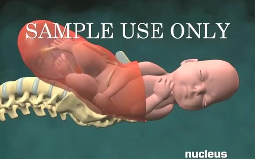 3D动画演示，宝宝顺产出生全过程