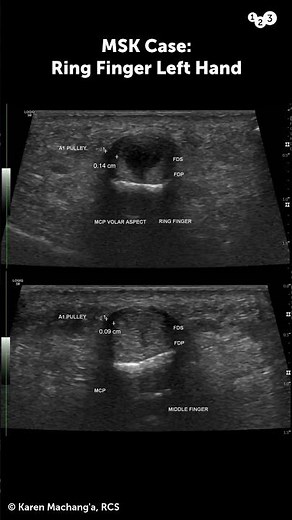 Here's an MSK case study!