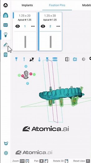 🦷 Unleash the Potential of Tissue-Supported Guide Design with Atomica AI Software!🔬