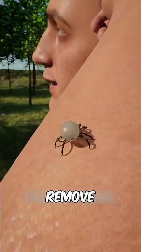 Never Pull a Tick Like This! (Safe Tick Removal Tips)😳🕷️