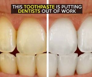 Would you use this on your teeth? CREDIT: https://www.amazon.com/SUMIGAKI-JAPANESE-CHARCOAL-TOOTHPASTE-Japan/dp/B000LP5C6G/ref=sr_1_2_a_it?ie=UTF8&qid=1481552109&sr=8-2&keywords=charcle toothpaste | LOLKidz