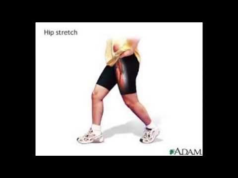 Pinched Nerve in Leg | How to Get Rid of Trapped Nerve in Leg