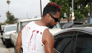Miguel Leaves Studio With a Briefcase While Wearing Blood-Stained Shirt; Unreleased Demos Released Online