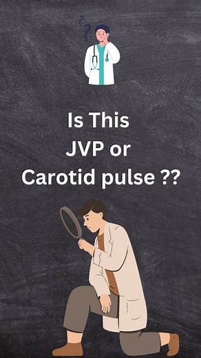 Dr Vishal Gabale | Jugular venous pressure vs carotid pulsations !! #medicine #jvp #cardiology #viva | Instagram