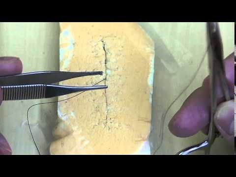 Subcuticular Skin Closure