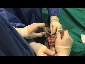 Técnica de Winograd