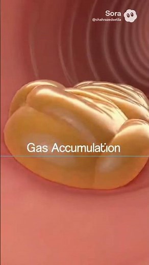 Flatulence – The Journey of Intestinal Gas #shortvideo
