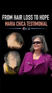 From Hair Loss to Hope | Maria Chica's Scarring Alopecia Testimonial