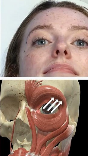 How to mark up for a brow lift 💉