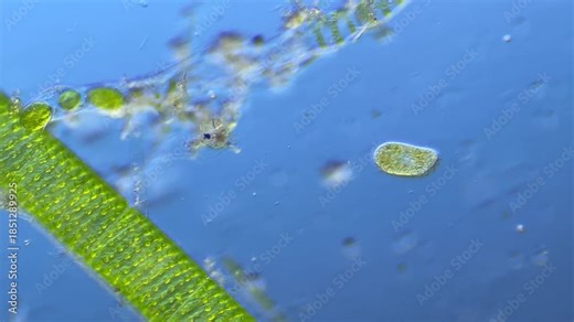 Protists Ciliates under the microscope at 100x Magnification