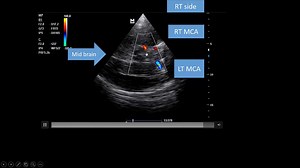 6.6K views · 62 reactions | A glimpse of our recorded Critical Care...
