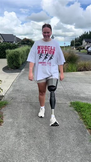 My Journey as a Cancer Survivor and Amputee