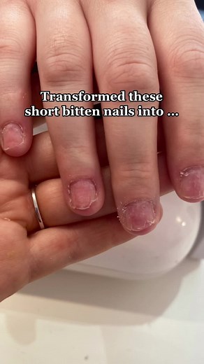 Achieving Healthy Nail Growth with BIAB Gel Extensions