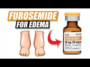 Furosemide for Edema