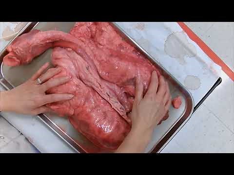Sheep pluck dissection