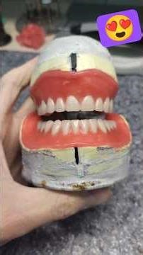 manufacturing of a removable denture