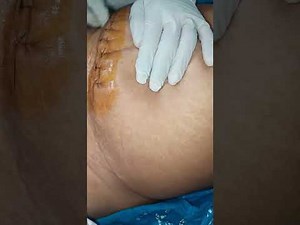 Dressing technique for nursing students