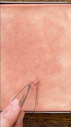 How to do a buried figure of 8 suture 🪡