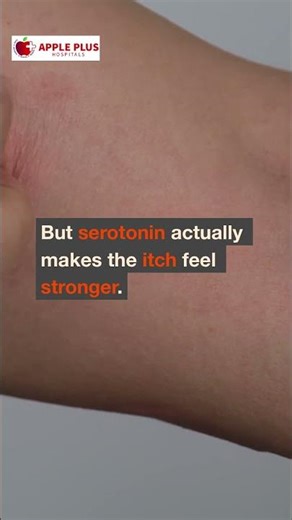 “Why You Can’t Stop Scratching an Itch”