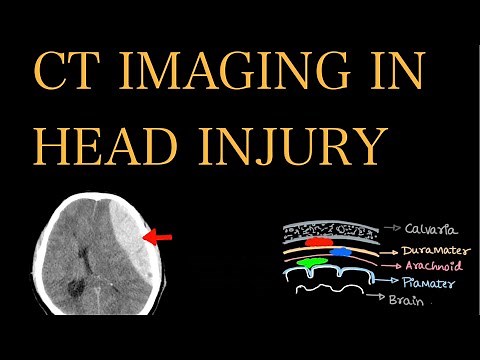IMAGING IN HEAD INJURY (CT)