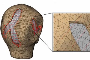 Virtual Surgery shows surgeons how wounds will heal