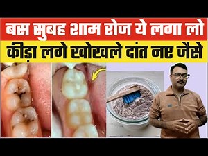 दाँतो की हर एक समस्या का समाधान | न कीड़ा लगेगा न दाँत कभी खोखला होगा | DIY Tooth Powder