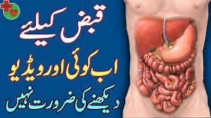 13 reactions | Constipation types Causes and treatment | Medical Diary | Facebook