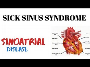 Sick Sinus Syndrome SSS | Sinoatrial disease | medinject